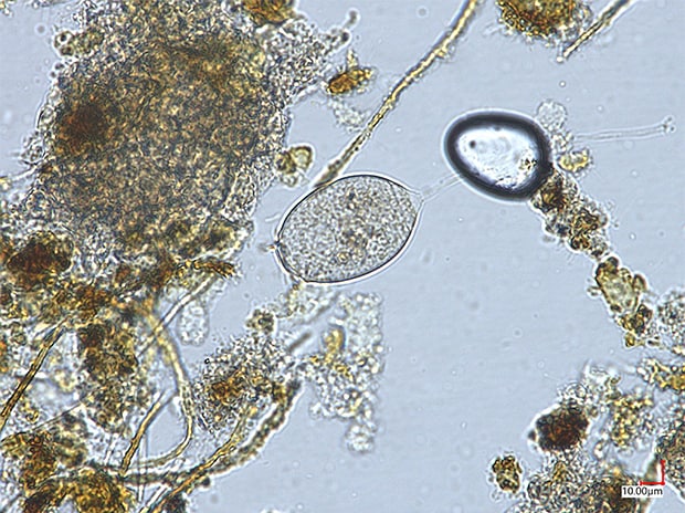 Microorganism in water, 700x,<br>observation with transmitted illumination