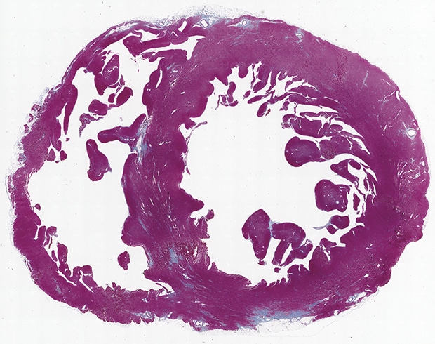 Hybrid Cell Count