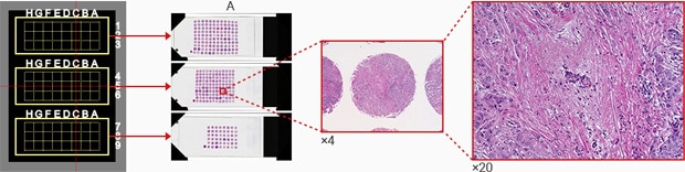Tissue microarray