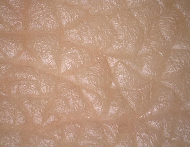 Multi-lighting image of skin texture (skin replica)