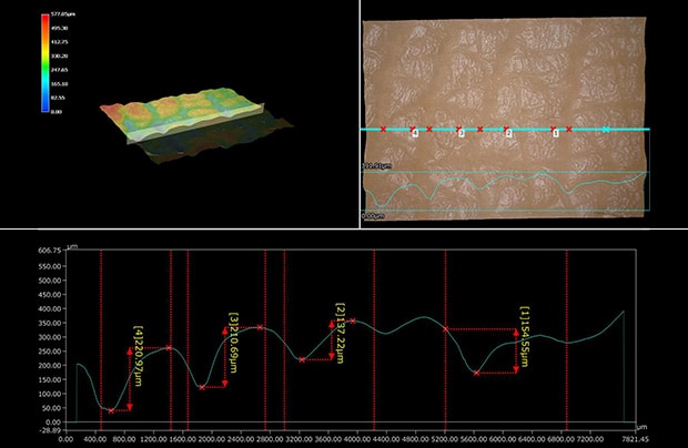 3D profile of skin surface
