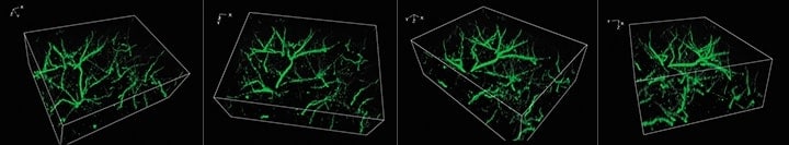 Capturing clear images without fluorescence blurring