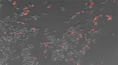 Counting cells using a phase contrast image