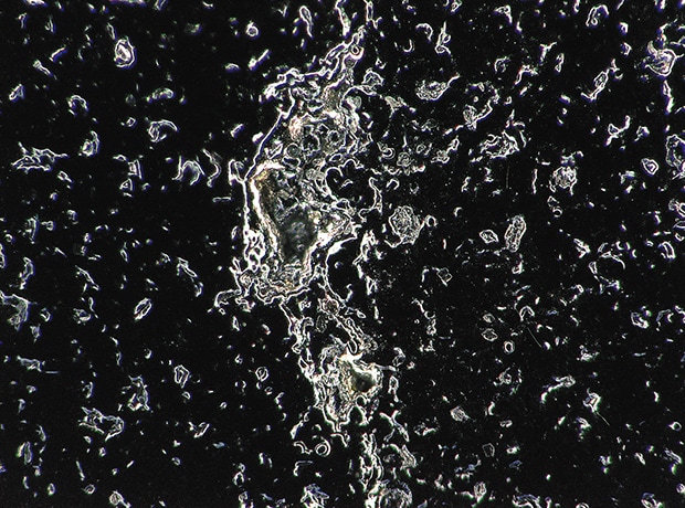 Cast surface (200x)