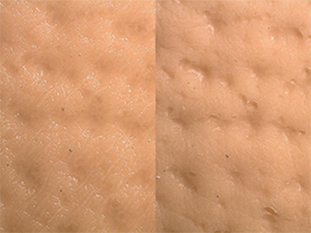 Observation and Measurement of Foundation Using Digital Microscopes