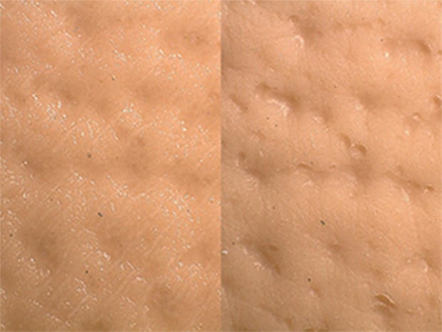 ZS-20, 50×, Multi-lighting image; left: after application, right: before application The Multi-lighting function can be used to clearly view the subtle textures of the skin as well as how the foundation has been applied.