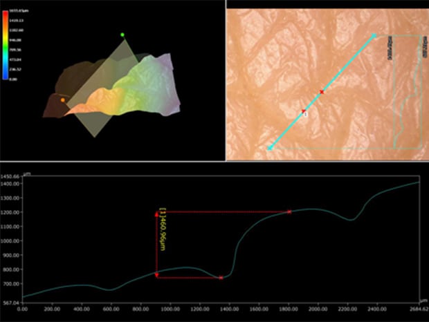 VH-Z20, 100×, ring illumination 3D profile measurements of skin can be performed with no need to use a replica.