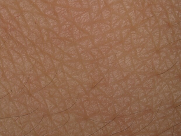 VH-Z20, 20×, ring illumination, normal image