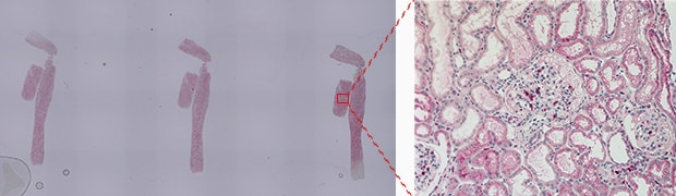 Analysis example of CD68 (macrophage) glomerulus occupancy rate