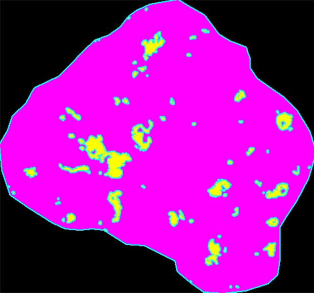 CD68 (macrophage) area: 998 μm2