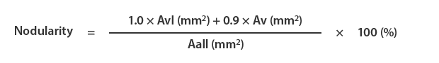 Calculating the graphite nodularity
