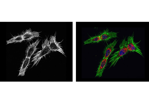Figure 3-2: BZ's high-sensitivity imaging with a cooled CCD (left) and multi-color fluorescence labeling (right)