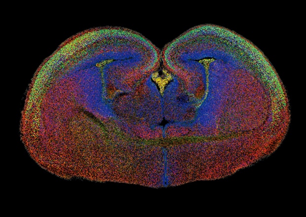 Figure 3-3: BZ's stitched image of a whole brain with multi-color fluorescence labeling