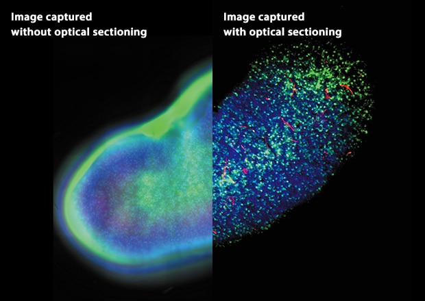 Figure 4-2: Kidney whole-mount (left) and mouse brain neurons (right)