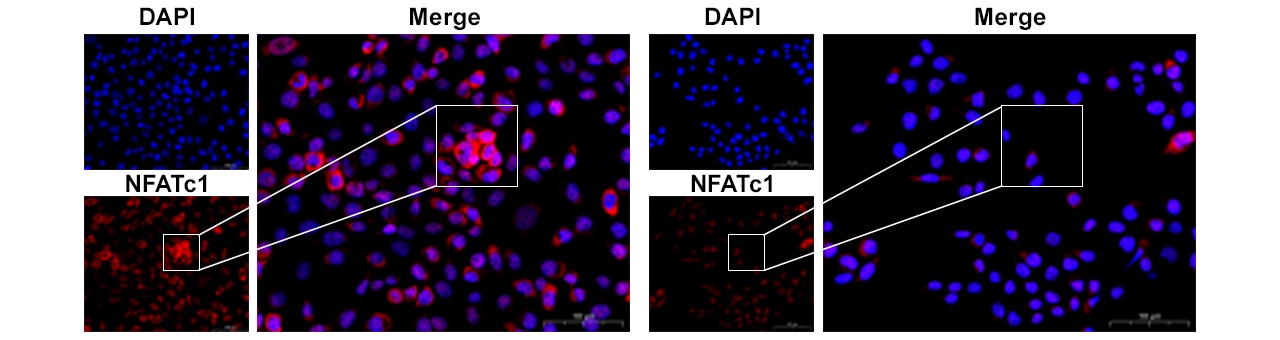 Blue: Cell nuclei, Red: NFATc1