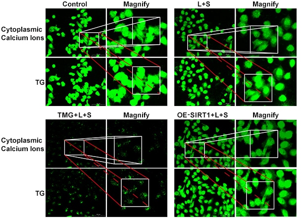 Target: Endoplasmic Reticulum