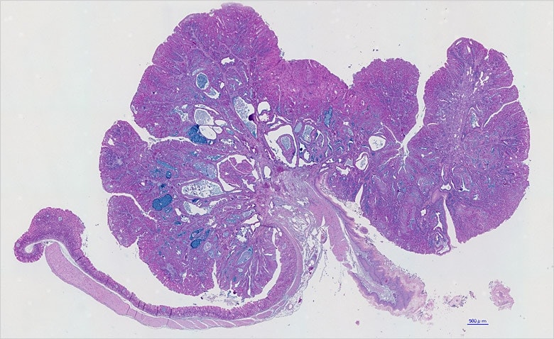 Image: Wide-area image of mouse stomach obtained from image stitching on the BZ Series