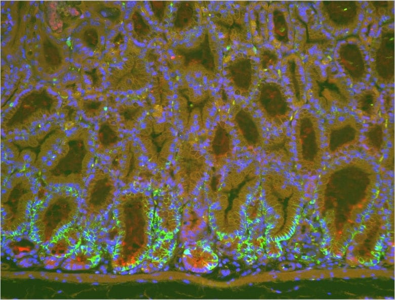 Image: Fluorescent magnified image of stomach before using the haze reduction function