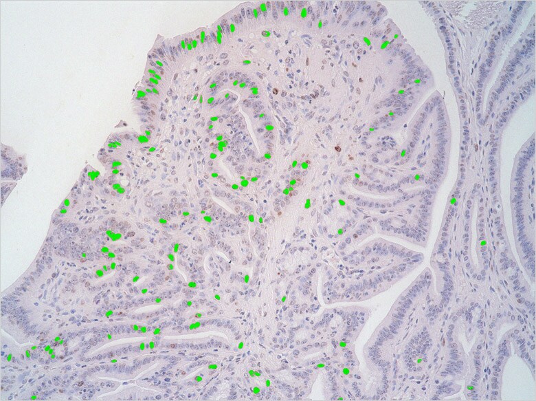 Image: Image after using the cell count function