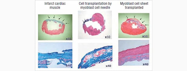 Image: From the left, comparative images of: heart...