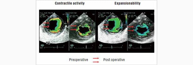 Image: Transplant results of a myoblast cell sheet...