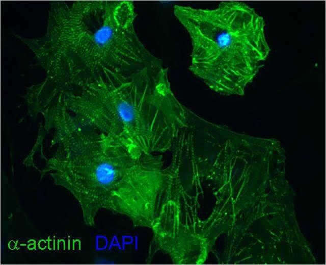 Image: Differentiation-induced myocardial cells from iPS cells...