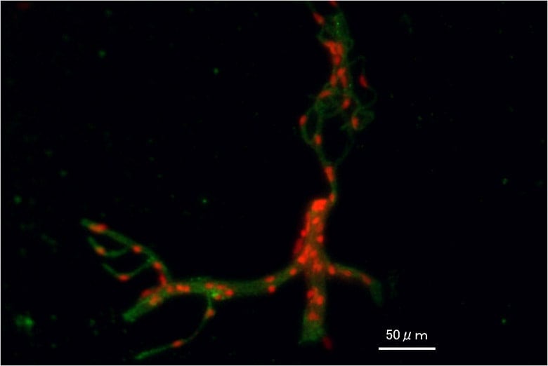 Image: Blood vessel in brain captured with the BZ Series...