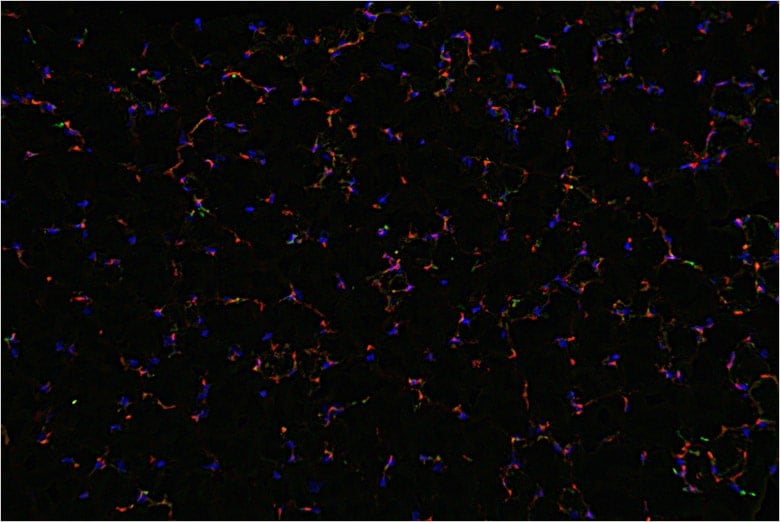 This picture was sharpened using the haze reduction function. The bone marrow cells and blood vessels are clearly shown.