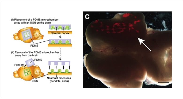 Image: Implantation (transcription) of an artificial neural network...