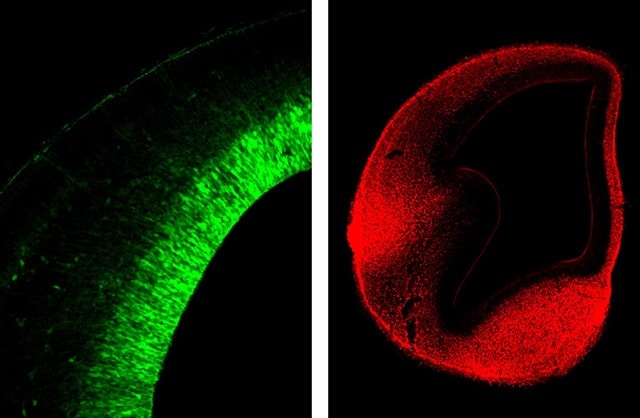 Images: The photograph on the left depicts a neural stem cell, the base of the nervous system...