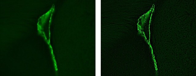 Images: Stained magnified images of ependyma cells of an adult mouse...