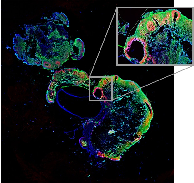 Figure 1: Brain organoid containing neural progenitor cells and neurons (Imaged with the BZ Series)