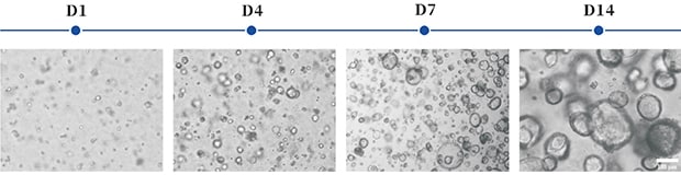 Figure 3: Culture process of a gastric cancer organoid