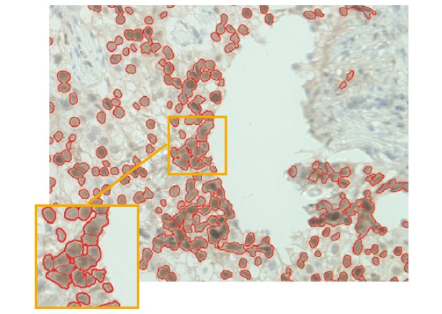 Using the separation function to count adjacent cells individually