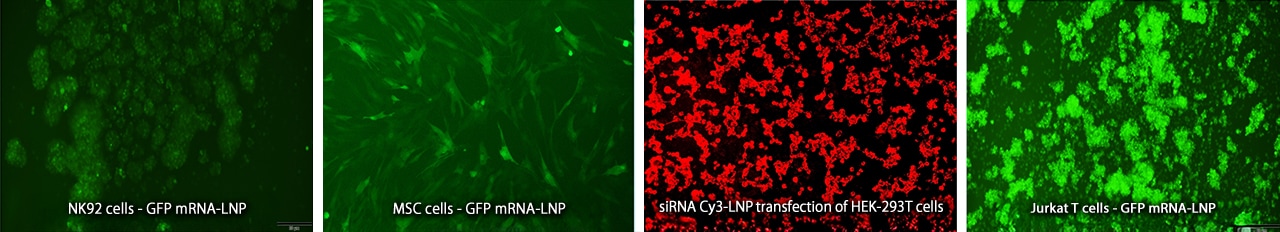 All of the above are fluorescence images of various transfected cells captured with the BZ-X