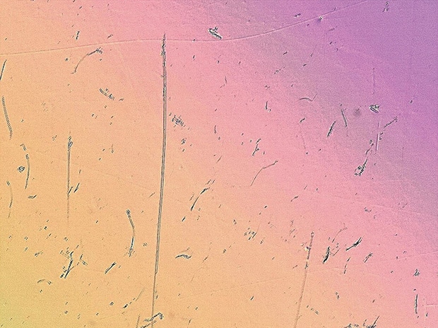 Differential interference contrast (DIC) image (400x)