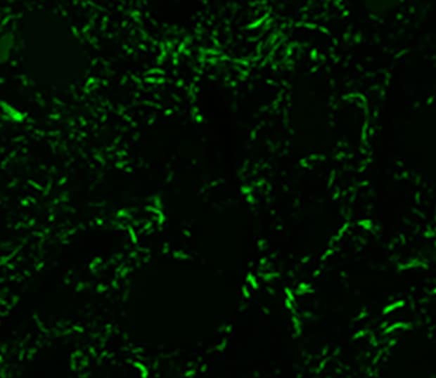 Fluorescence image