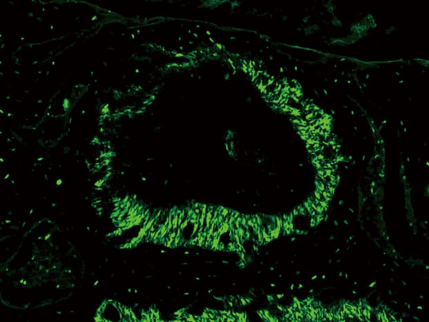 Capturing clear images without fluorescence blurring