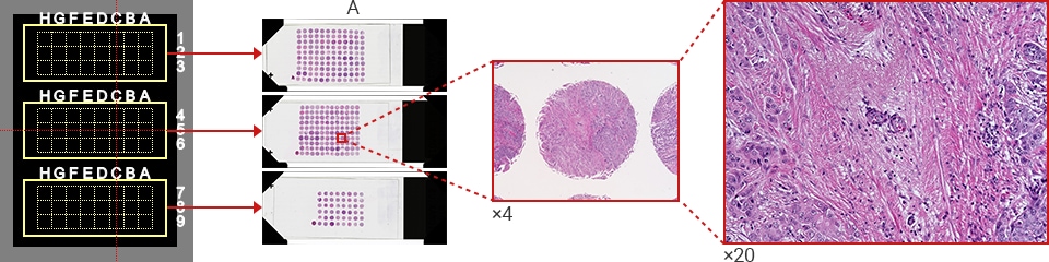 Tissue microarray