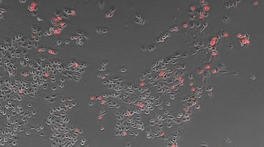 Counting cells using a phase contrast image