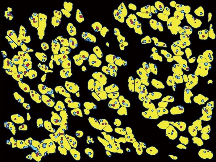 Hybrid Cell Count