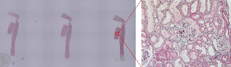 Analysis example of CD68 (macrophage) glomerulus occupancy rate