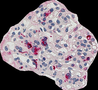Glomerulus area: 23407 μm2