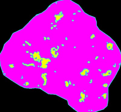 CD68 (macrophage) area: 998 μm2