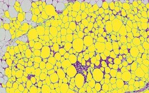 Quantitative Analysis of Fat Cells