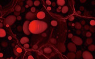 Observing Autofluorescence of Plants by Removing Out-of-focus Emissions