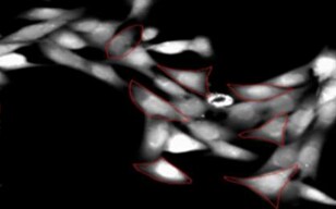 Calcium Imaging Using a Fluorescence Microscope