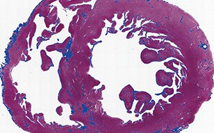 Measuring the Cardiac Fibrosis of Macaca Fascicularis (Crab-eating Macaque)