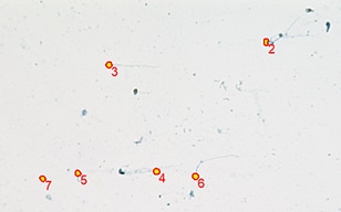 Sperm Inspection via Christmas Tree Staining