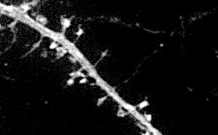 Mouse Cerebral Cortical Neuron Spine